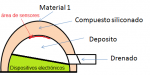 corte lateral.png corte lateral.png
